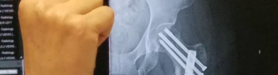 rajalary, scribbles writing, julie lary, rich lary, prosthetic