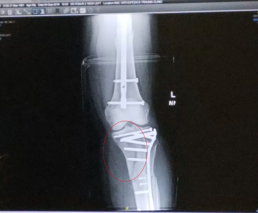 julie lary, rich lary, rajalary, scribbles writing, tibia