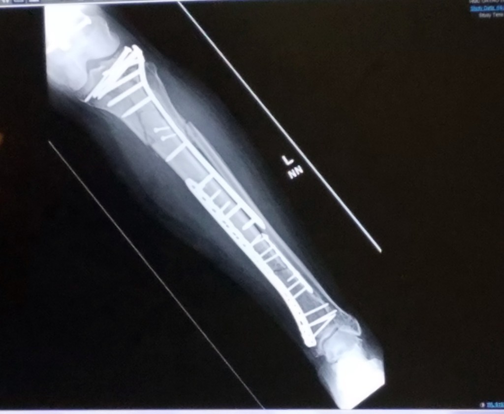 rajalary, rich lary, julie lary, scribbles writing, tibia