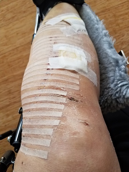 rajalary, rich lary, julie lary, scribbles writing, accident